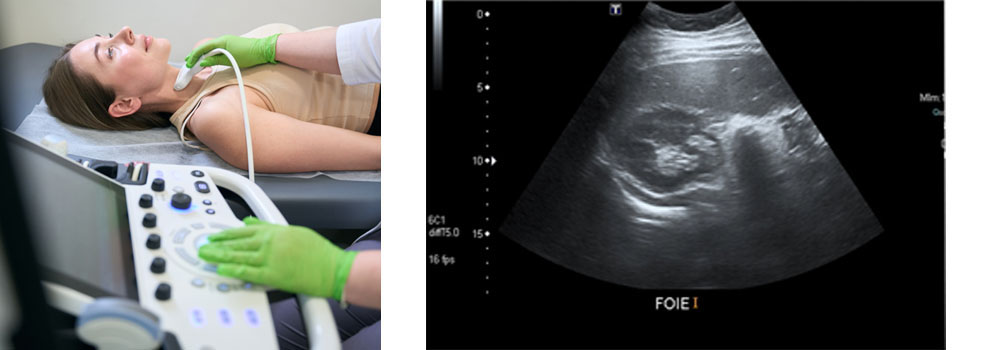 ecocardiografia aviles